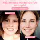 Infibella™ | Rejuvenece 10 años en 4 semanas