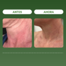 1 + 1 GRATIS | SKIN FIRMING™ Reduce las arrugas y reafirma la piel en 7 días