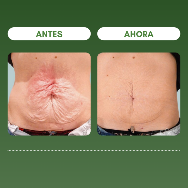 1 + 1 GRATIS | SKIN FIRMING™ Reduce las arrugas y reafirma la piel en 7 días - Image 2