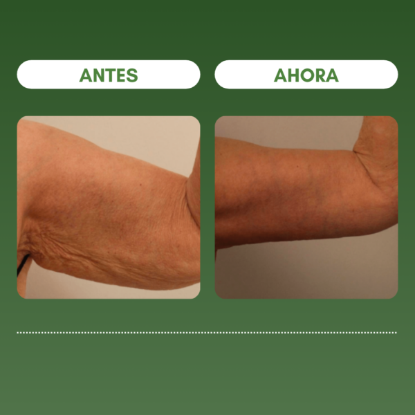 1 + 1 GRATIS | SKIN FIRMING™ Reduce las arrugas y reafirma la piel en 7 días - Image 3