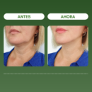 1 + 1 GRATIS | SKIN FIRMING™ Reduce las arrugas y reafirma la piel en 7 días