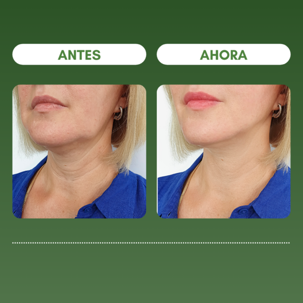 1 + 1 GRATIS | SKIN FIRMING™ Reduce las arrugas y reafirma la piel en 7 días - Image 5