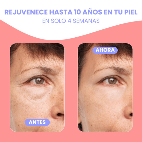 LiftSkin™ | Efecto lifting al instante. Reducí visiblemente las arrugas, la papada y la hinchazón para lograr una apariencia esculpida y más definida - Image 8