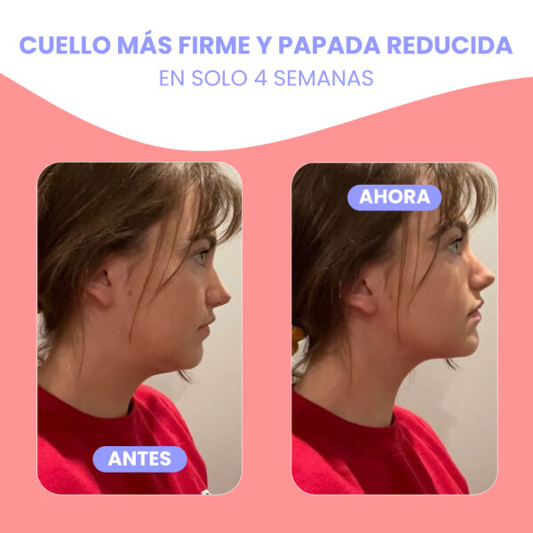 LiftSkin™ | Efecto lifting al instante. Reducí visiblemente las arrugas, la papada y la hinchazón para lograr una apariencia esculpida y más definida - Image 10