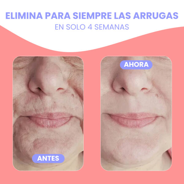 LiftSkin™ | Efecto lifting al instante. Reducí visiblemente las arrugas, la papada y la hinchazón para lograr una apariencia esculpida y más definida - Image 6