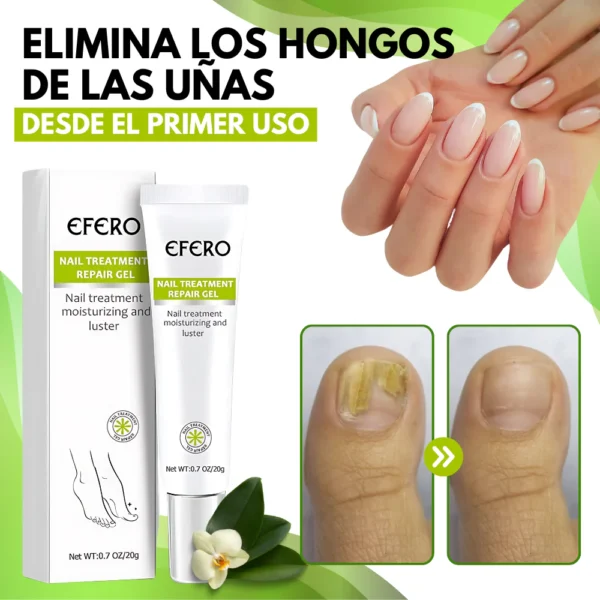 MYCARE™ ELIMINA LOS HONGOS DE LAS UÑAS EN 5 DÍAS Y EVITA QUE APEREZCAN PARA SIEMPRE