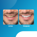 HydroSmile + Lápiz Blanqueador GRATIS