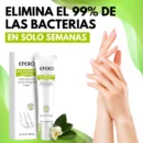 MYCARE™ ELIMINA LOS HONGOS DE LAS UÑAS EN 5 DÍAS Y EVITA QUE APEREZCAN PARA SIEMPRE